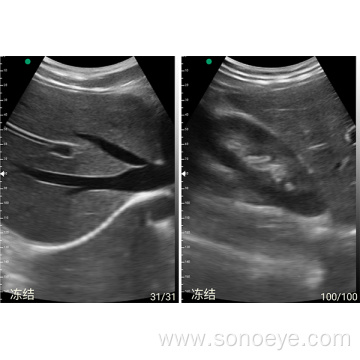 USB WIFI Type Ultrasound Probe Ultrasound